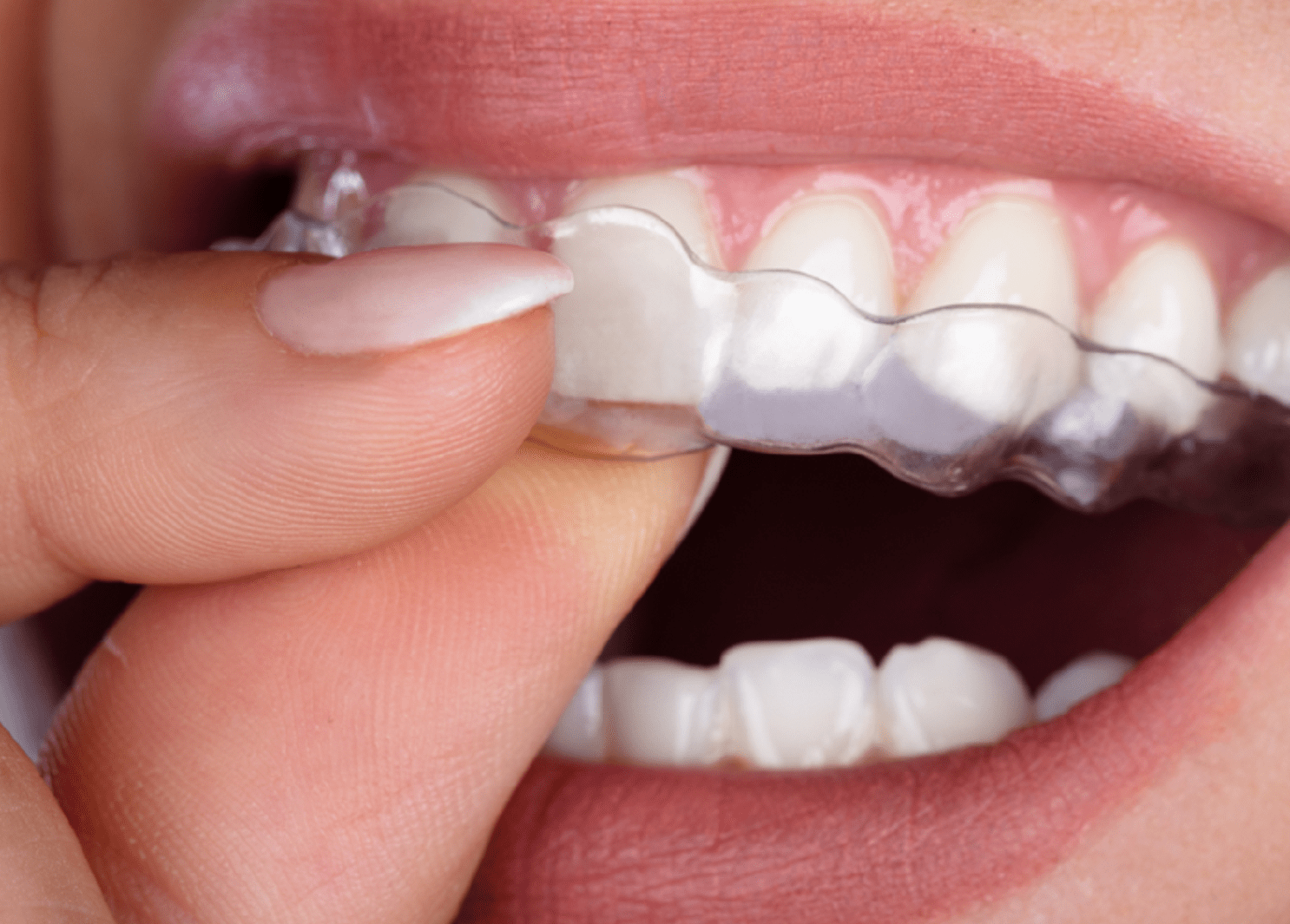 StarAligners-Image